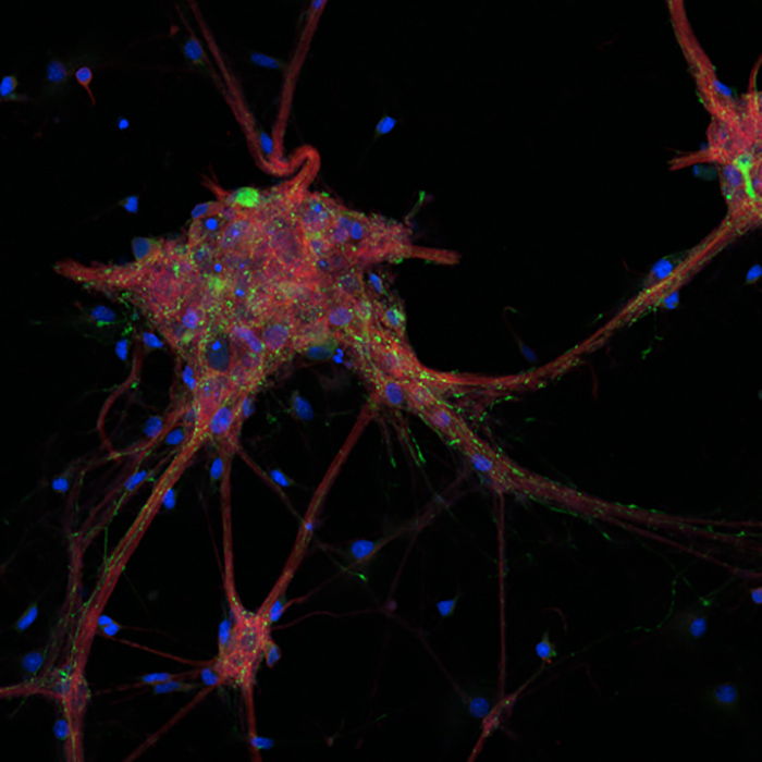 Cortical Neurons